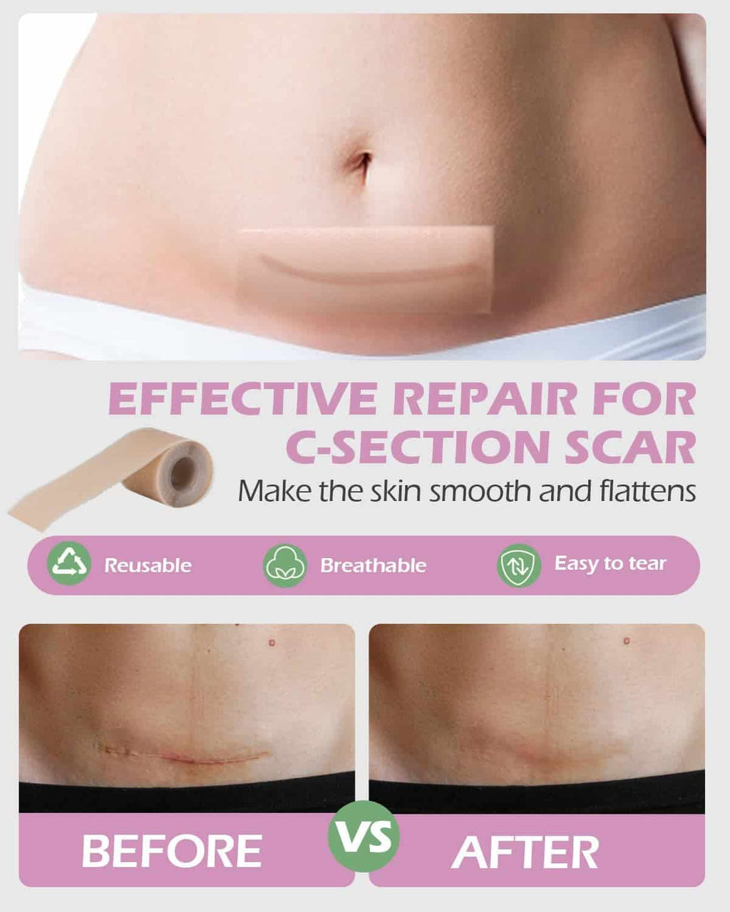 Kit de Recuperación Parto Cesárea